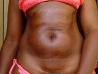 Ebonyquinter