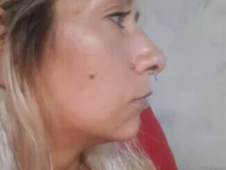 Pituromi