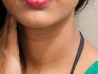 PUNAM779