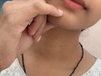 Cherry_lotion